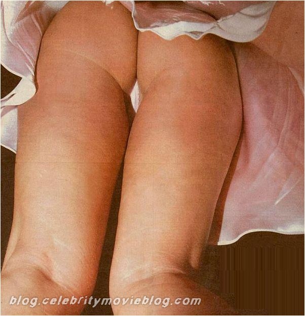Rachel Hunter